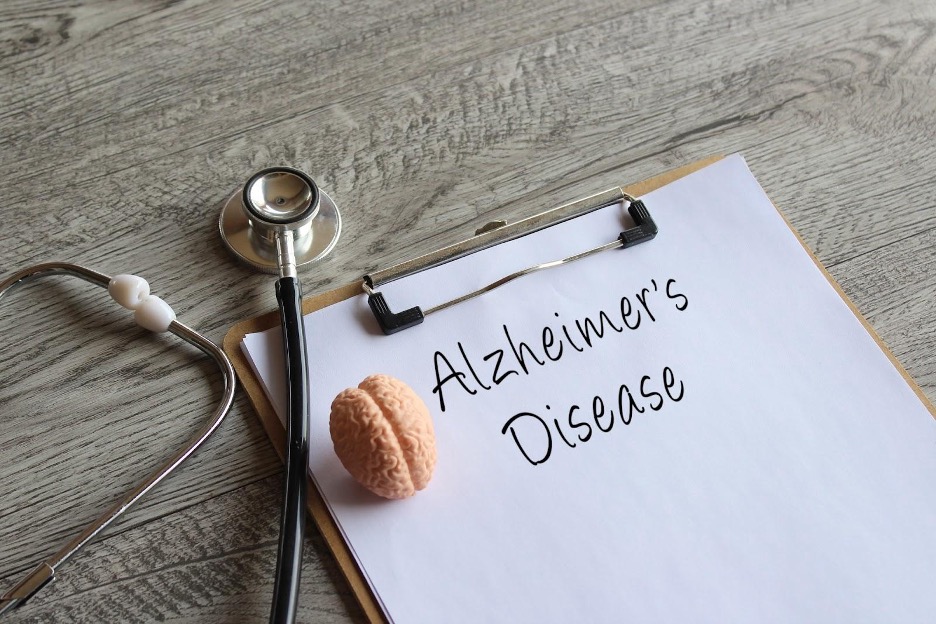 Clipboard with words Alzheimers Disease, stethoscope, and brain model